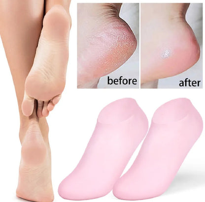 Pair Silicone Moisturizing Socks, Soft Silicone Socks for Cracked Feet Women and Men Foot Moisturiser Socks Foot Spa Pedicure Silicone Gel Socks for Cracked Feet Dry Skins Calluses.